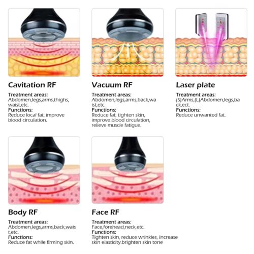S-SHAPE 5 EN 1 lipolaser - Imagen 4