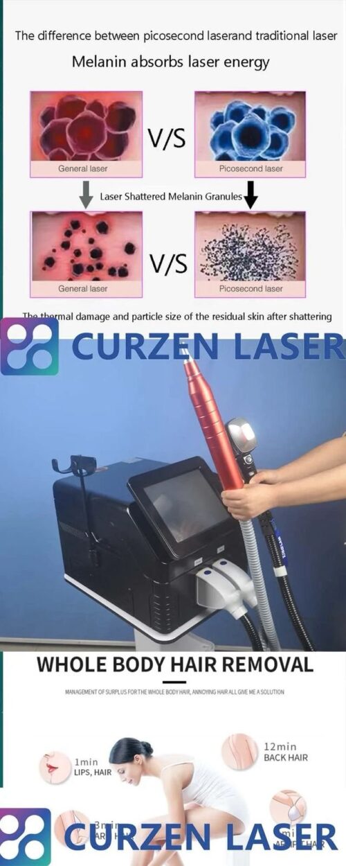 DEPILADORA LASER DIODO SOPRANO TITANIUM ICE + LASER ND YAG - Imagen 5
