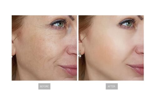 BIOLIGHT PDT 6 en 1 - Imagen 6