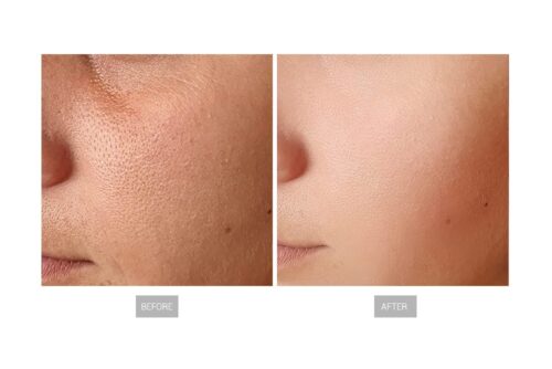 BIOLIGHT PDT 6 en 1 - Imagen 7